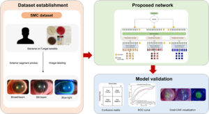 Diagram illustrating the overall study design and proposed Vision Transformer (ViT) framework for Keratitis Diagnosis using broad-beam, slit-beam, and blue-light anterior segment images.