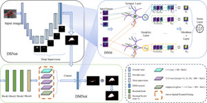 3DL-Net’s three-stage architecture: preliminary segmentation, multi-scale context extraction, and dendritic refinement for precise medical image analysis.