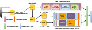 complete overview of our proposed model for brain tunor classification