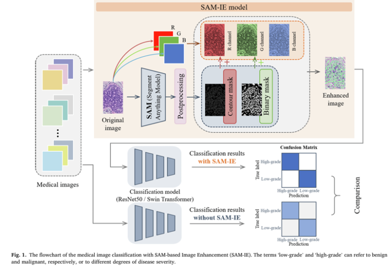 The flowchart of the medical image classification with SAM-based Image Enhancement (SAM-IE). The terms ‘low-grade’ and ‘high-grade’ can refer to benign and malignant, respectively, or to different degrees of disease severity.