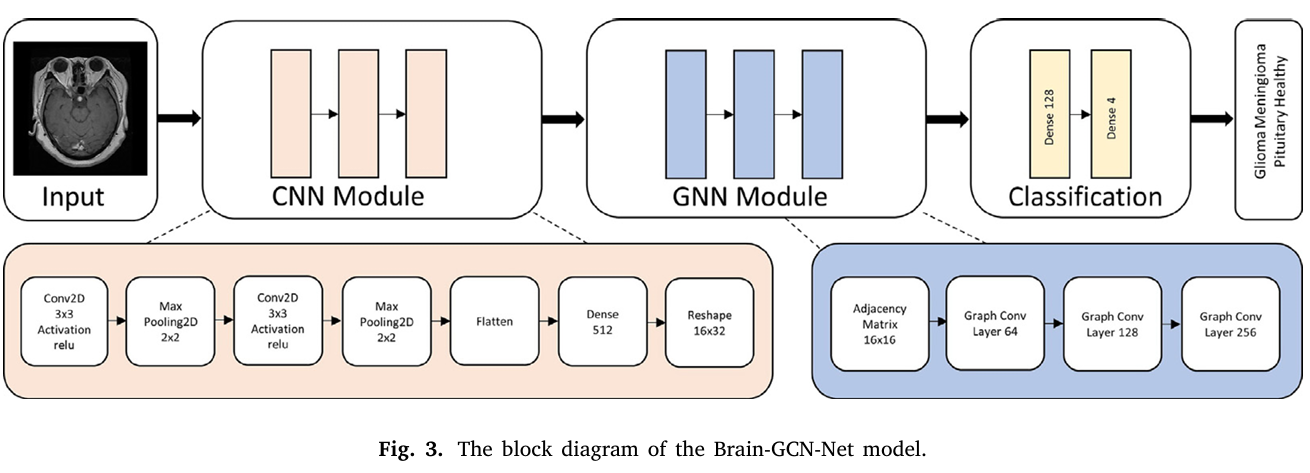 Brain GCN NET: Graph neural network nodes overlaid on a brain MRI slice illustrating CNN GNN fusion for tumor classification