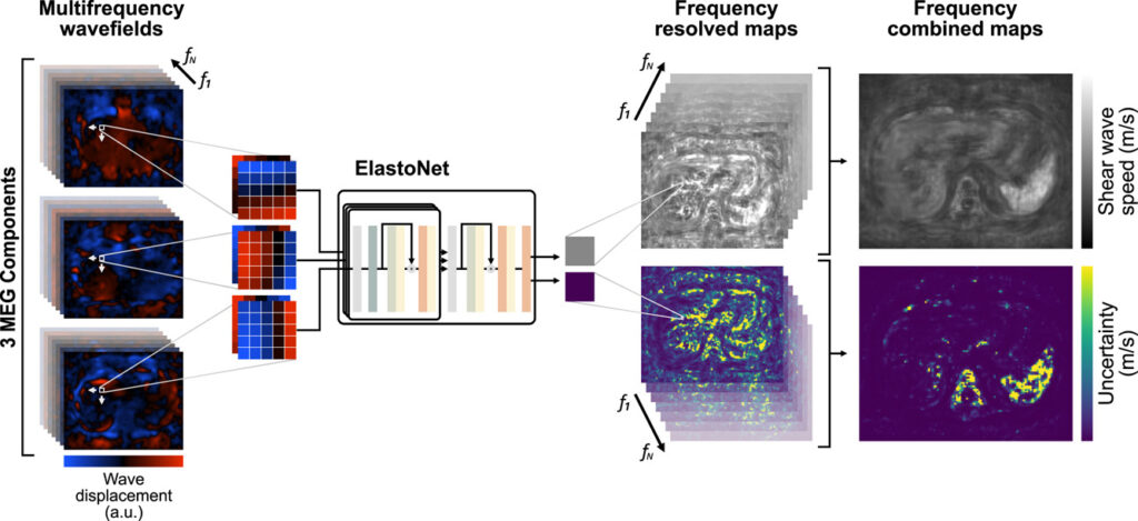 ElastoNet: A revolutionary neural network approach to MR Elastography inversion with uncertainty quantification.