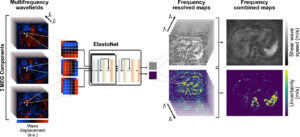 ElastoNet: A revolutionary neural network approach to MR Elastography inversion with uncertainty quantification.