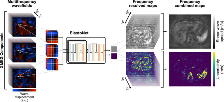 ElastoNet: A revolutionary neural network approach to MR Elastography inversion with uncertainty quantification.