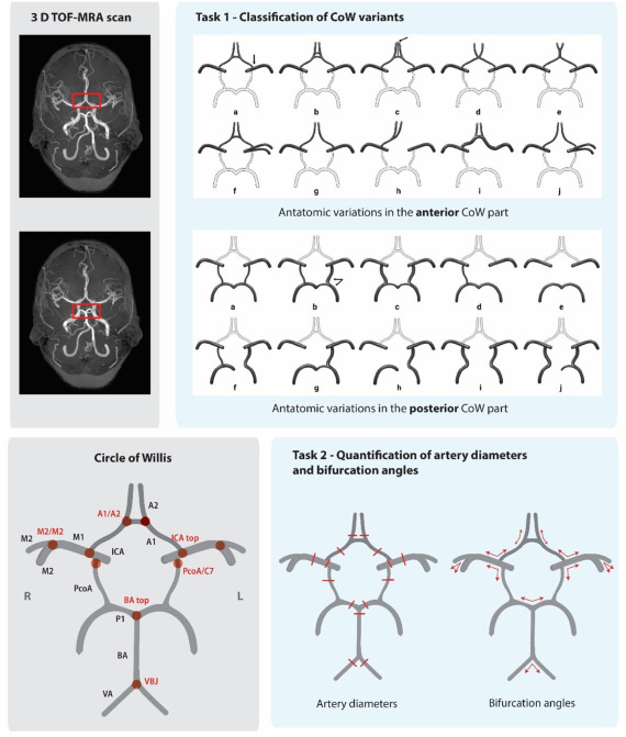 AI algorithms analyzing 3D TOF-MRA scans of the Circle of Willis for aneurysm risk prediction in Crown challenge