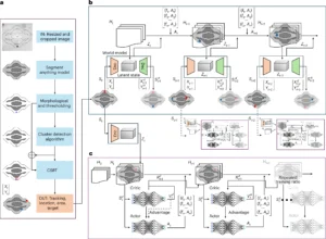 AI-controlled ultrasound microrobots navigating complex vascular networks with precision under microscopic view