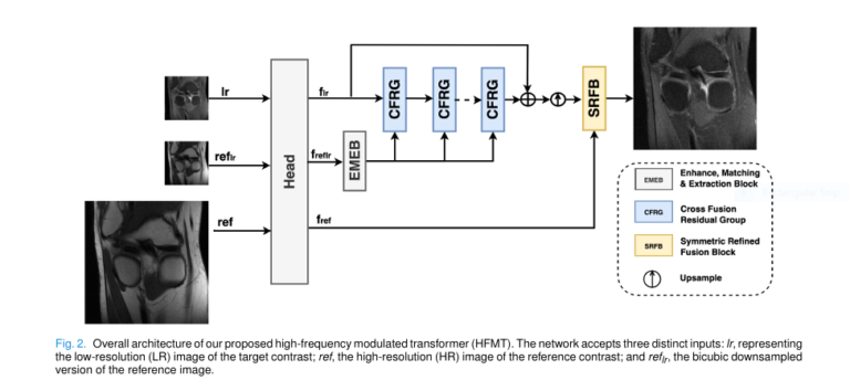 (HFMT architecture) from the paper with alt text: "Diagram of HFMT model showing EMEB, CFRG, RWTB, HFFB, and SRFB modules for MRI super-resolution.