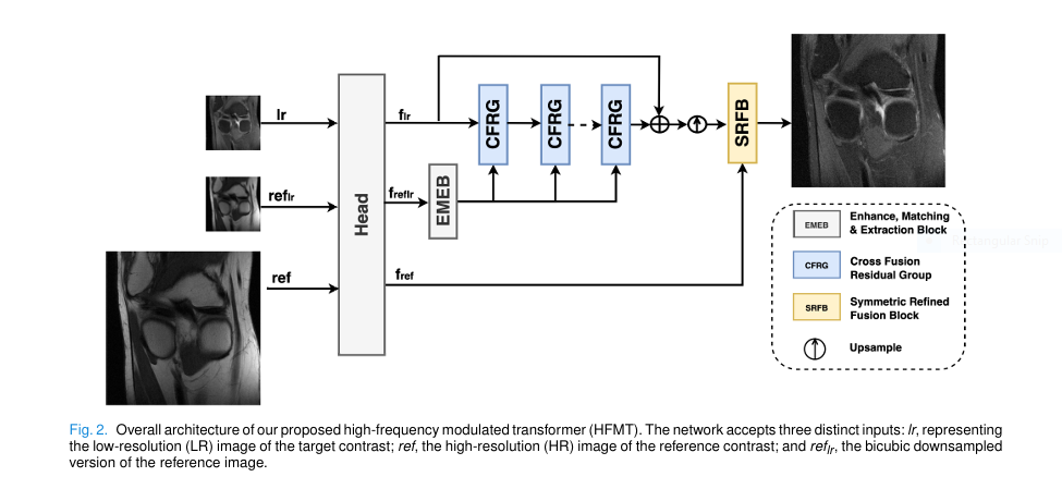 (HFMT architecture) from the paper with alt text: "Diagram of HFMT model showing EMEB, CFRG, RWTB, HFFB, and SRFB modules for MRI super-resolution.