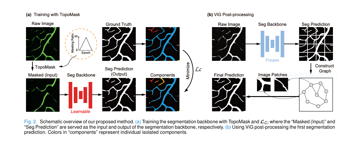 Illustration of a fragmented retinal blood vessel network being reconnected by an AI segmentation and completion model called MaskVSC
