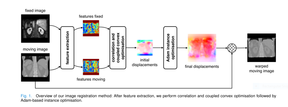 ConvexAdam framework diagram showing feature extraction, correlation layer, coupled convex optimization, and Adam-based refinement for 3D medical image registration.