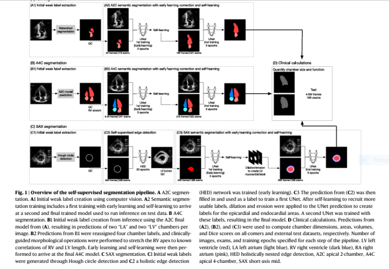 AI in Cardiac Ultrasound: Self-Supervised Learning Revolutionizing Heart Imaging