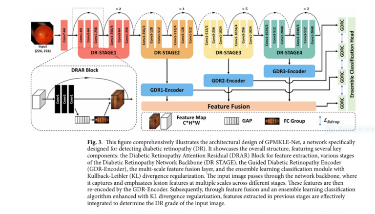 6 Groundbreaking Innovations in Diabetic Retinopathy Detection: A 2025 Breakthrough