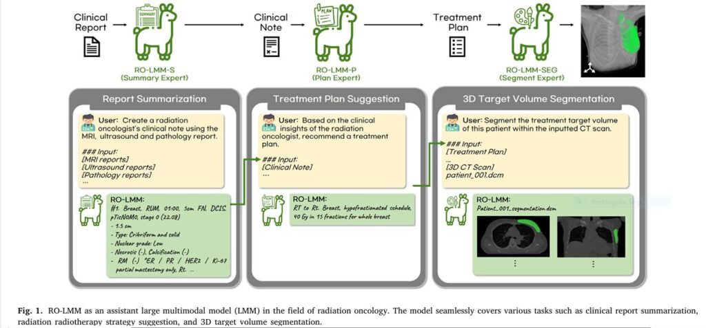 RO-LMM AI system seamlessly processing MRI, ultrasound, and pathology reports to generate precise radiotherapy plans and 3D target segmentations for a breast cancer patient."
