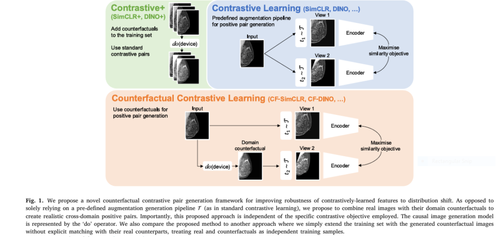 Counterfactual contrastive learning closes the performance gap between majority and minority scanners, especially where it matters most: in low-data settings and real-world deployments