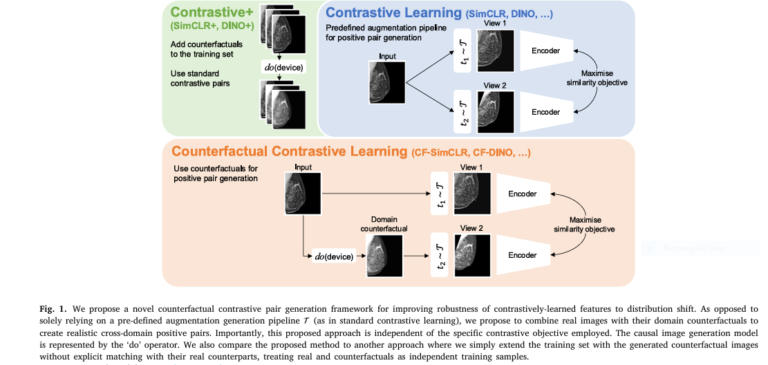 Counterfactual contrastive learning closes the performance gap between majority and minority scanners, especially where it matters most: in low-data settings and real-world deployments
