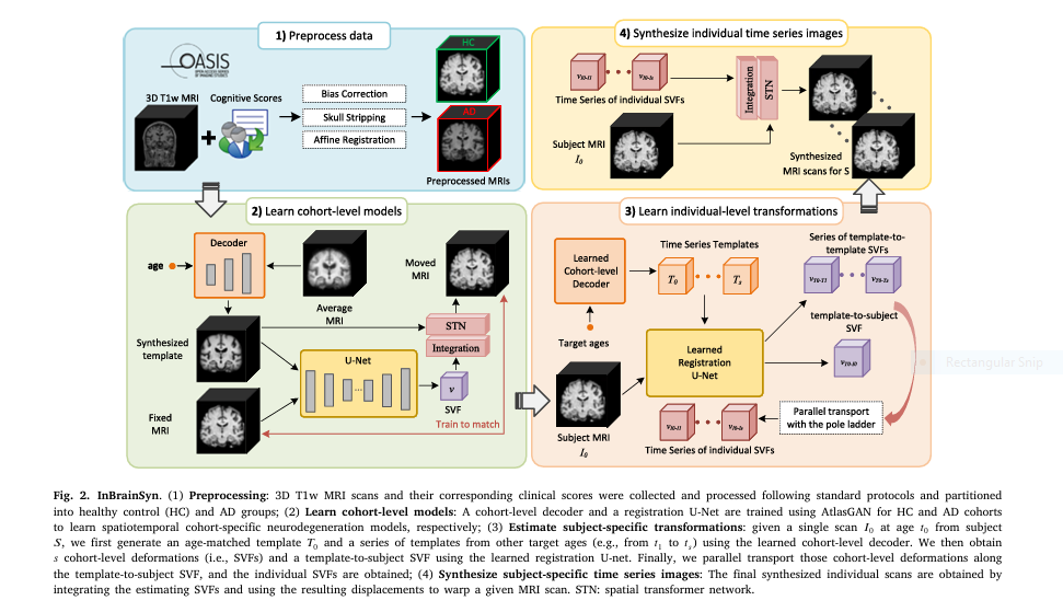 Simulation of individualized brain aging and Alzheimer’s progression using AI with diffeomorphic registration