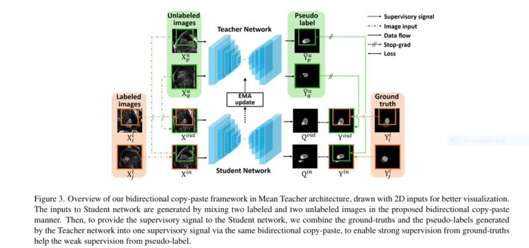 Medical AI using bidirectional copy-paste technique in semi-supervised segmentation
