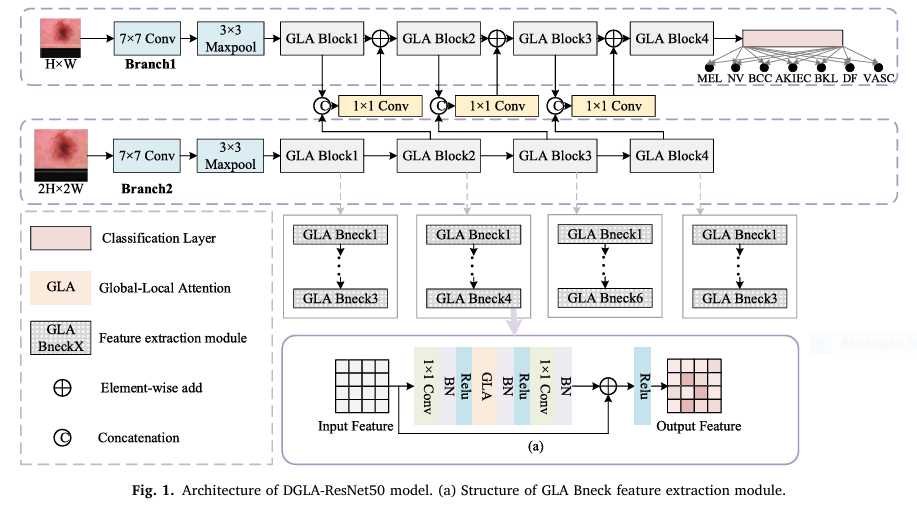 Architecture of DGLA-ResNet50 model. (a) Structure of GLA Bneck feature extraction module.