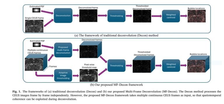 Super-resolution ultrasound with multi-frame deconvolution improving microbubble localization