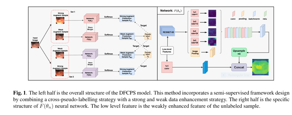 DFCPS AI model accurately segmenting gastrointestinal polyps in endoscopic imagery with minimal labeled data.