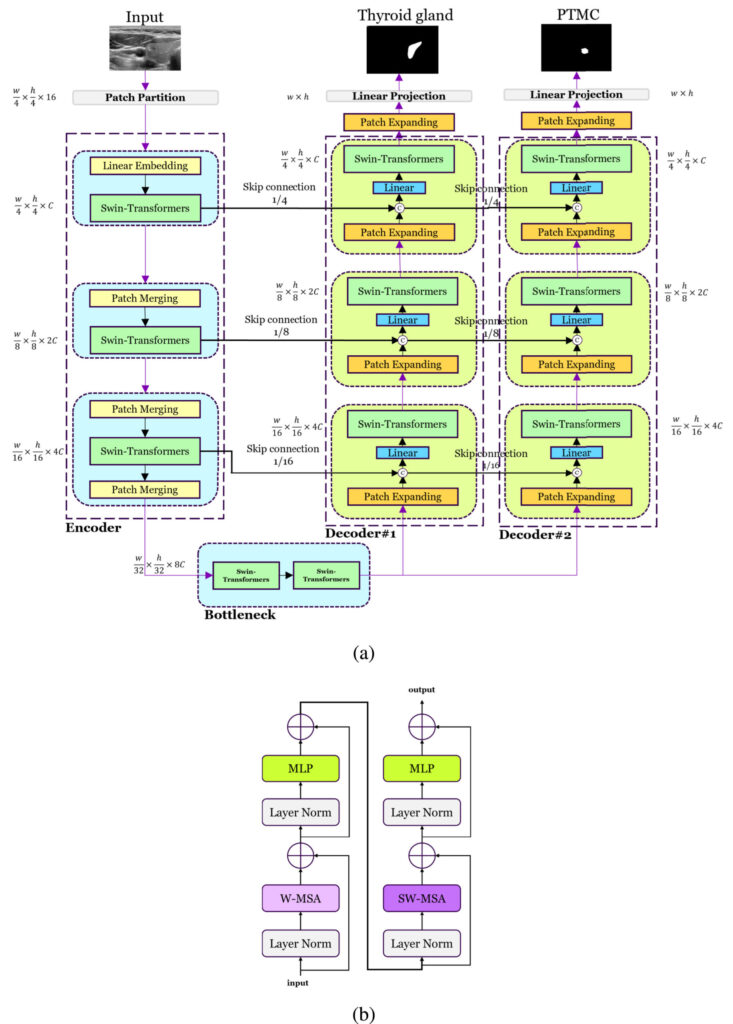 DualSwinUnet++ architecture diagram showing dual-decoder design for precise PTMC segmentation in ultrasound imaging