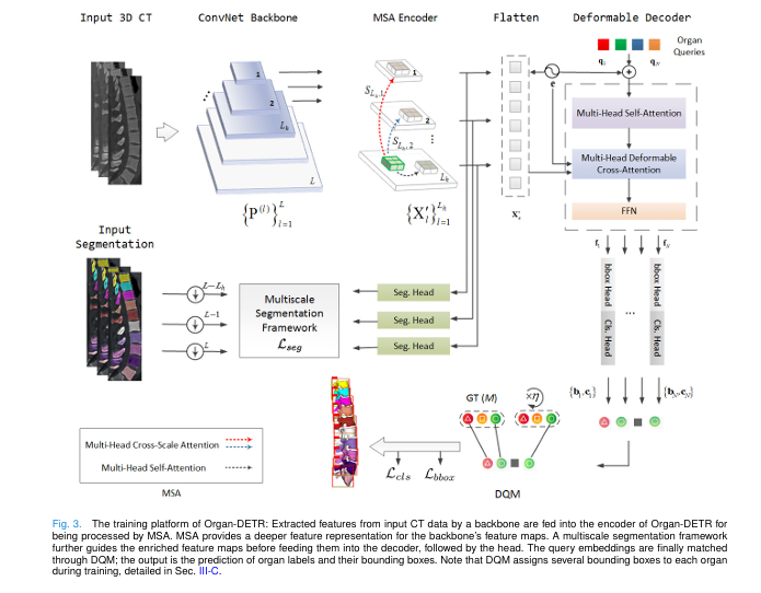 rgan-DETR model detecting liver and postcava in 3D Organ Detection CT scan with bounding boxes, outperforming traditional methods.
