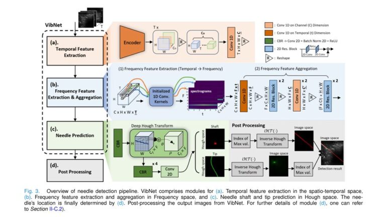 VibNet system detecting a nearly invisible needle in ultrasound using vibration-based deep learning. A red line highlights the predicted needle shaft and tip overlay on a grayscale ultrasound image