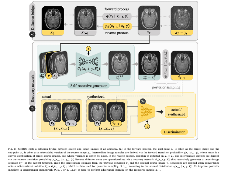 Diagram showing the SelfRDB diffusion bridge process transforming MRI to CT scans with high fidelity and noise robustness for medical image translation.