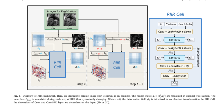 Illustration showing a futuristic AI-powered medical imaging analyzing a brain MRI, with digital neural network pathways glowing in blue, symbolizing the Recurrent Inference Image Registration (RIIR) process.