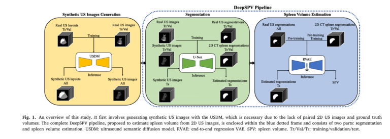 Discover DeepSPV—the first deep learning pipeline to estimate 3D spleen volume from 2D ultrasound