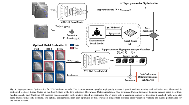 A medical AI system using YOLOv8 and hyperparameter optimization to detect coronary artery stenosis in invasive coronary angiography images.
