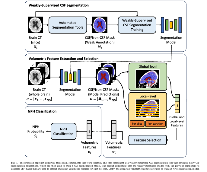 AI-powered brain scan analysis for NPH diagnosis showing CSF segmentation and ventricular volume metrics.