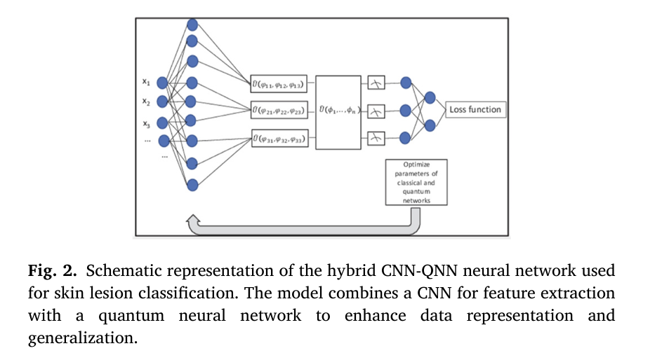 Infographic showing a hybrid CNN-QNN model analyzing a dermatoscopic image of a melanoma diagnosis, with quantum circuits and deep learning layers integrated.
