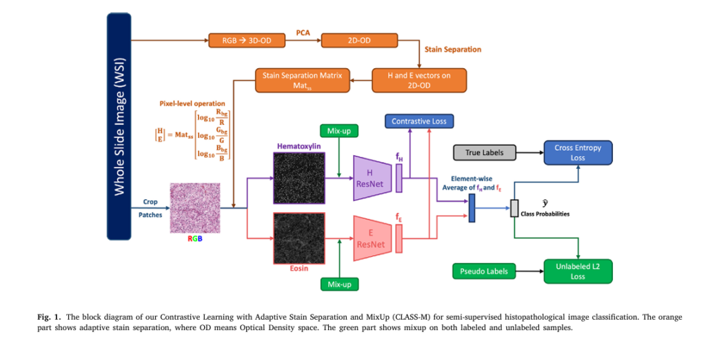 CLASS-M model outperforms existing methods in ccRCC classification with adaptive stain separation and pseudo-labeling.