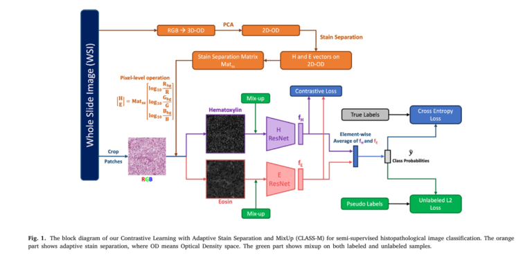 CLASS-M model outperforms existing methods in ccRCC classification with adaptive stain separation and pseudo-labeling.