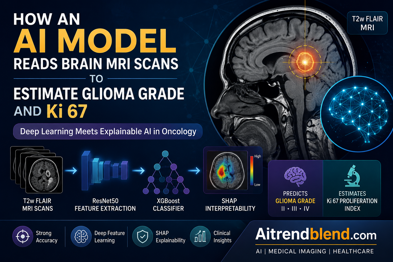 Brain MRI scan with glioma tumor region highlighted next to a SHAP feature importance chart used for Ki-67 prediction