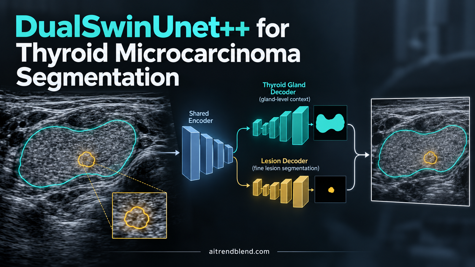 DualSwinUnet++ dual decoder Swin Transformer architecture segmenting thyroid gland context and papillary thyroid microcarcinoma lesions from B-mode ultrasound images
