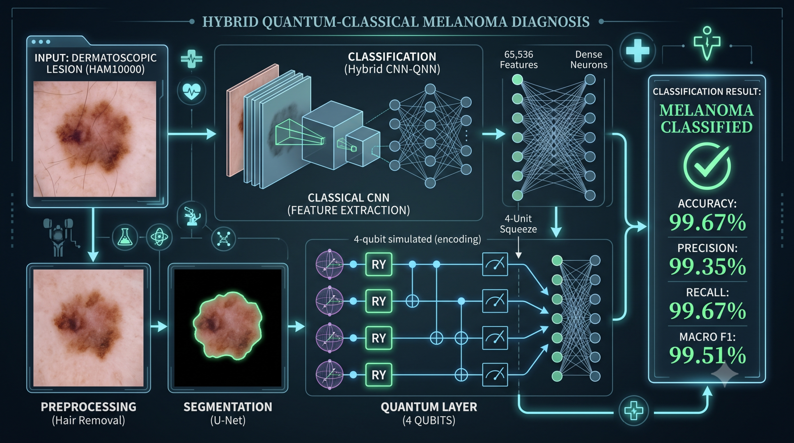 Dermatoscopic skin lesion image beside a segmented mask illustrating a hybrid CNN quantum neural network pipeline for melanoma classification