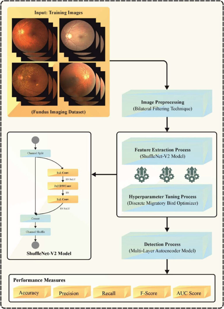 Discrete Migratory Bird Optimizer with Transfer Learning Aided Multi-Retinal Disease Detection