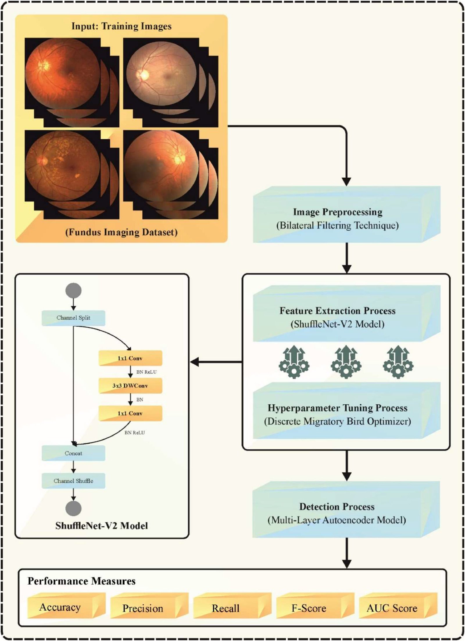 A fundus camera photograph of a human retina overlaid with an AI classification interface showing labels for diabetic retinopathy, glaucoma, and age related macular degeneration