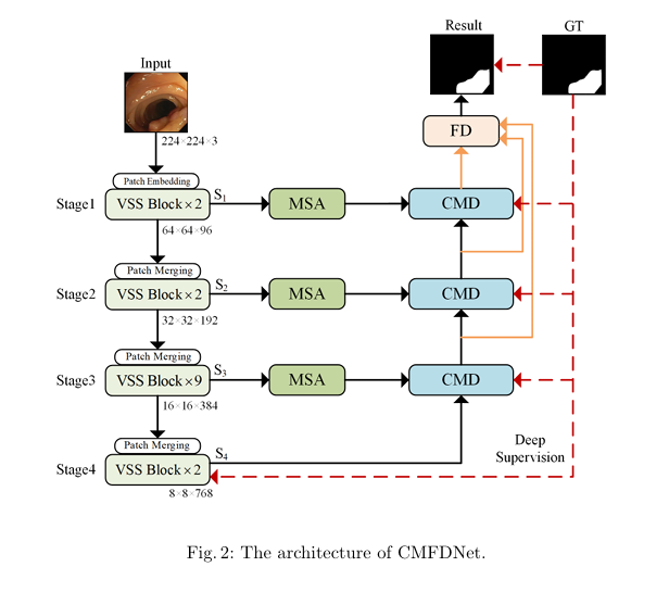CMFDNet architecture for automated polyp segmentation using Cross-Mamba Decoder and Feature Discovery Module