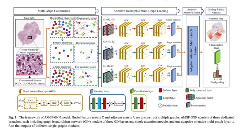 Visual representation of AMGF-GNN framework for tumor grading using multi-graph fusion in histopathology.