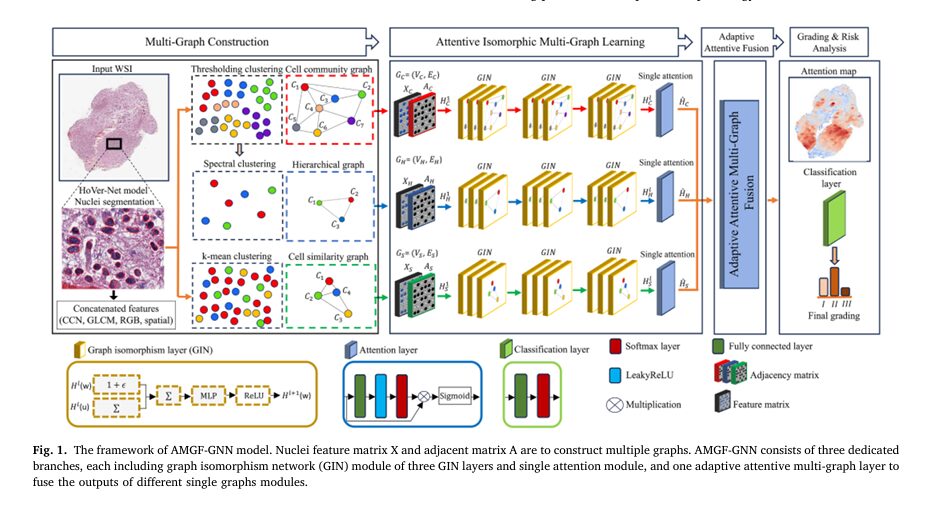 Visual representation of AMGF-GNN framework for tumor grading using multi-graph fusion in histopathology.