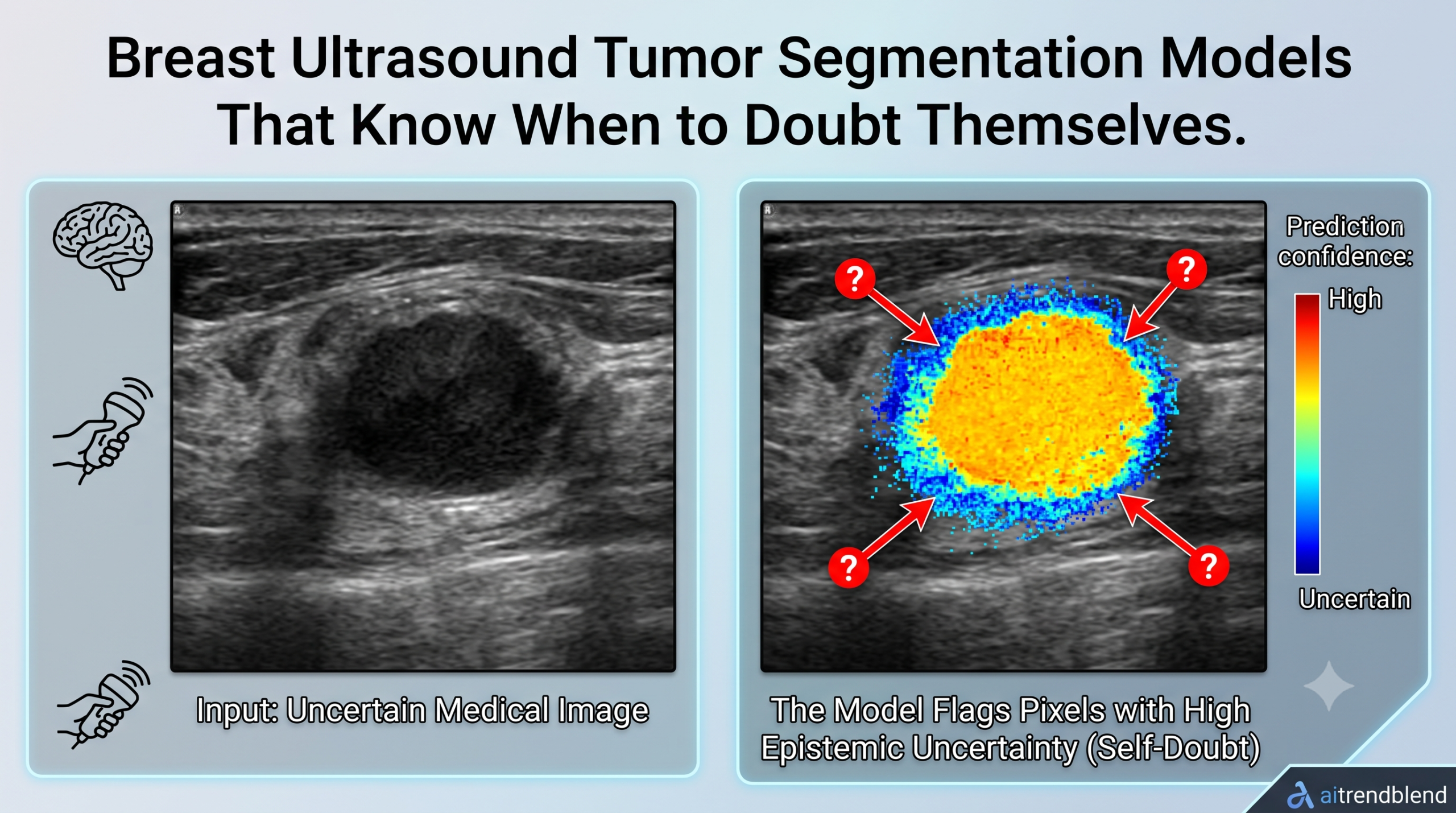 Towards Trustworthy Breast Tumor Segmentation in Ultrasound Using AI Uncertainty