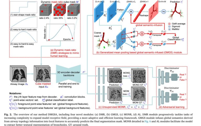 Revolutionary DMGSA Model: How AI is Transforming Automated Airway Segmentation for Lung Disease Detection