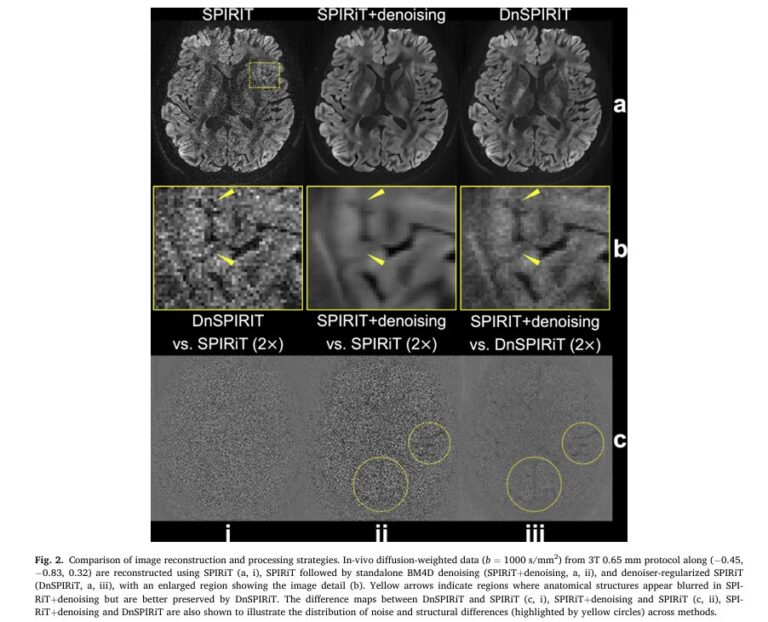 Submillimeter Diffusion MRI: Breakthrough Technology Mapping Brain Architecture with Unprecedented Detail