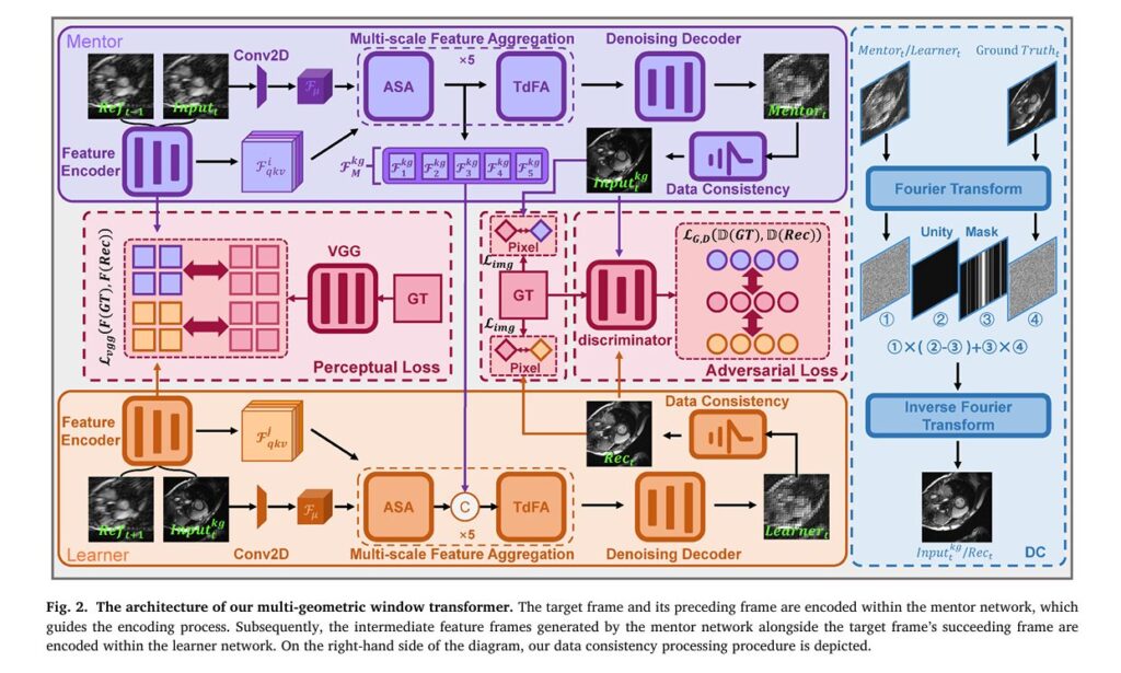 KGMgT: Revolutionary AI-Powered Cardiac MRI Reconstruction Achieves 10× Faster Scanning with Diagnostic-Quality Imaging