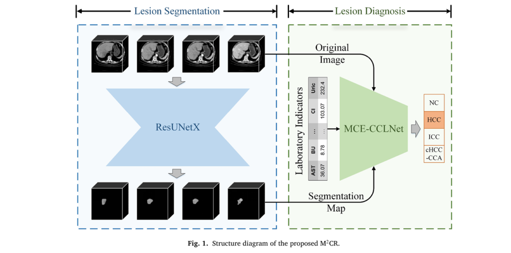 M2CR: Revolutionizing Primary Liver Cancer Diagnosis with AI-Powered Multimodal Analysis