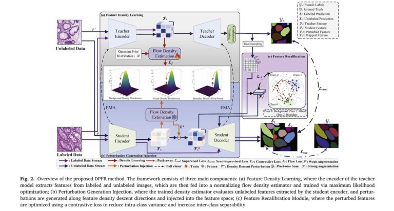 DPFR: A Breakthrough in AI-Powered Gland Segmentation for Cancer Diagnosis