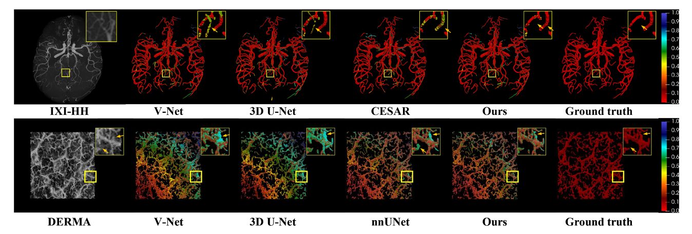 Structural Causal Model diagram showing nodes S, U, F, X, Y, E